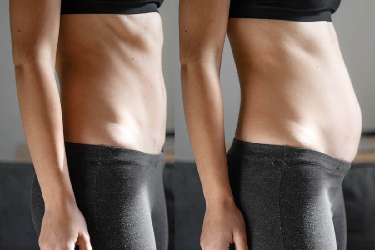 How long does diastasis recti take to improve South Yorkshire?