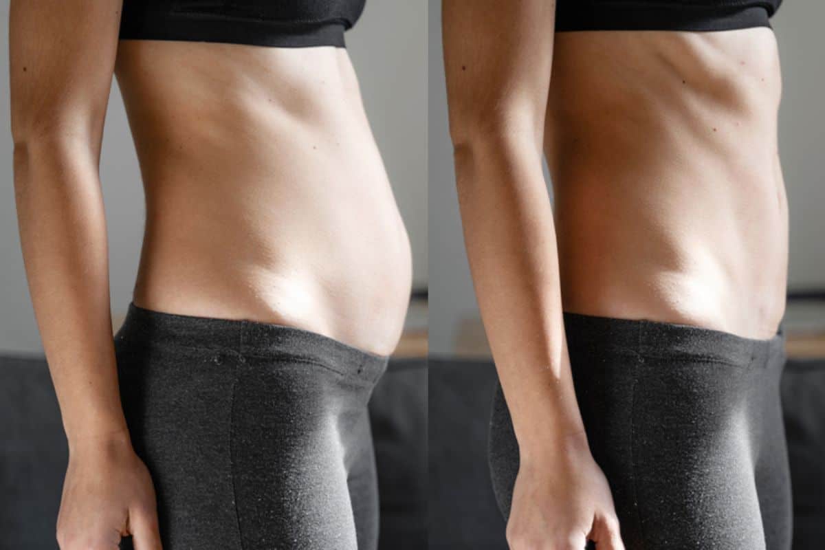 Post-Pregnancy: What Happens to Your Abdominal Muscles After Birth South Yorkshire