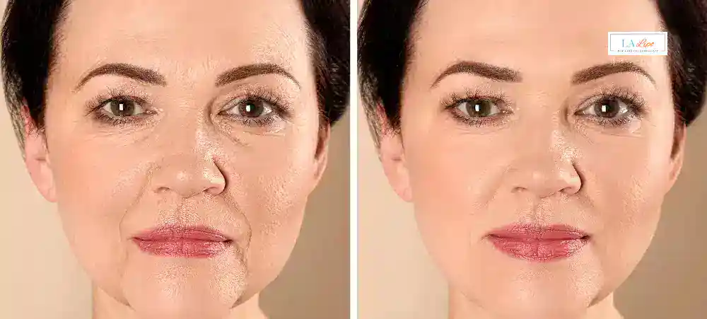 Why Aren’t My Skincare Products Making My Sagging Skin Look Firmer South Yorkshire?
